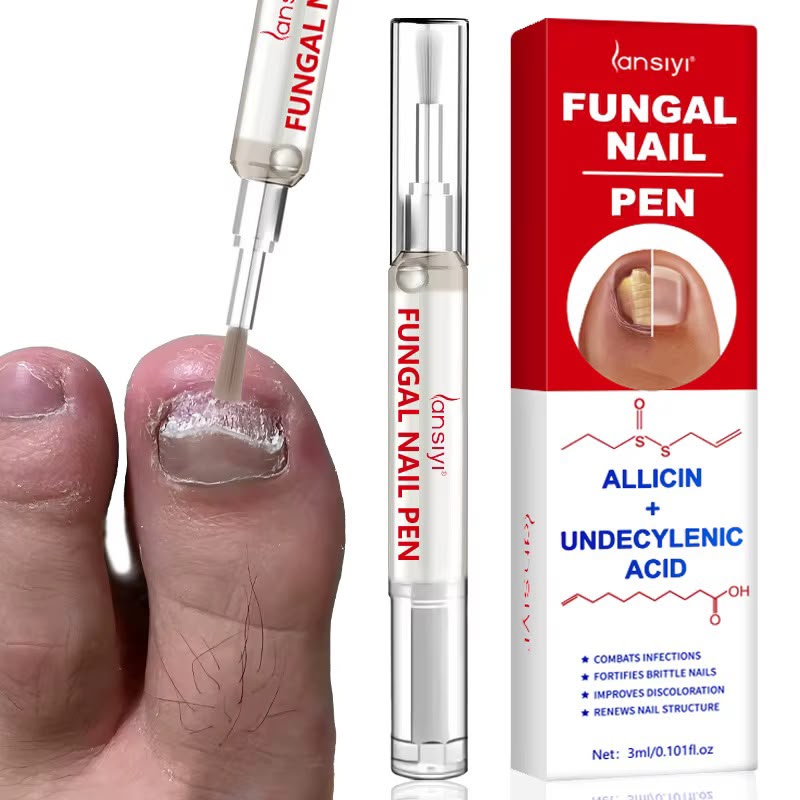 Mycose des ongles ? Découvrez le stylo antifongique ciblé